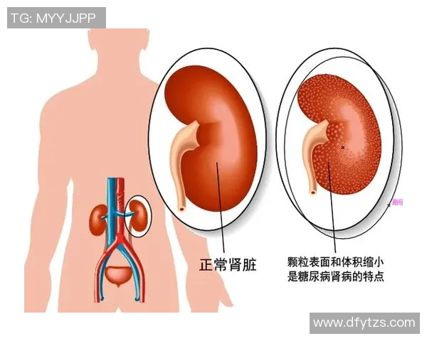 足球明星是否也会面临肾病风险及其健康管理的重要性探讨